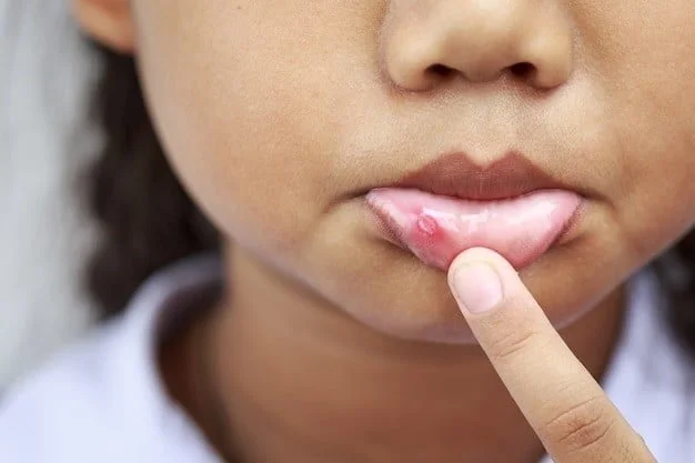 Decoding the Signs: What Your Body is Telling You with Itchy Lips