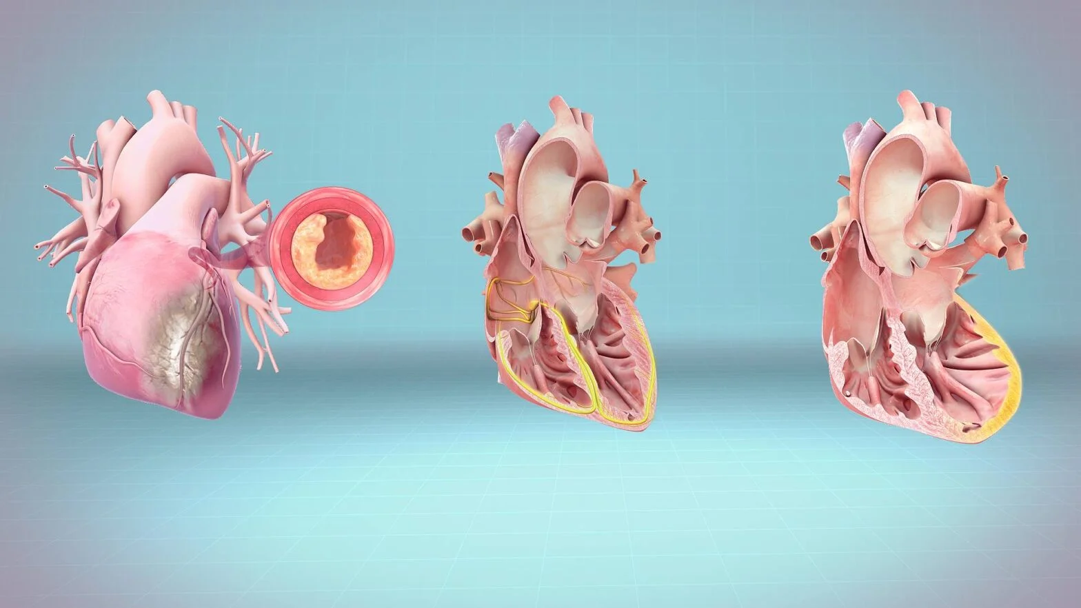 A Beginner’s Guide to Understanding Heart Disease