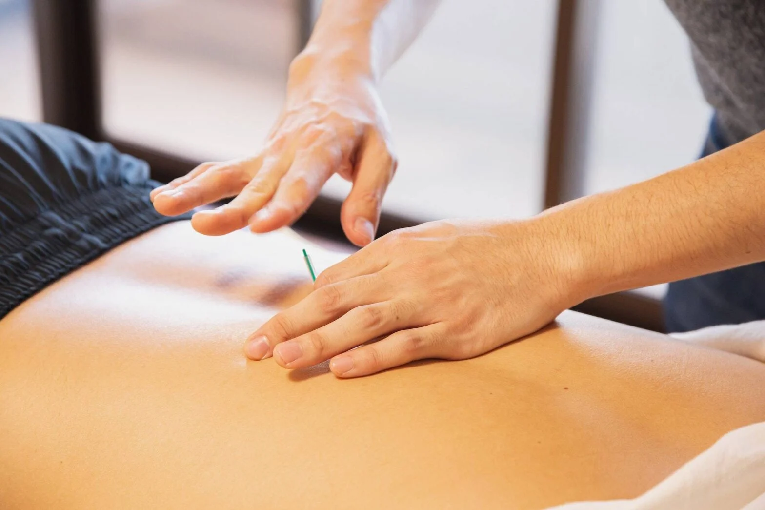 The Health Benefits of Acupuncture