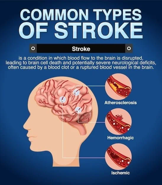 Unveiling the Underlying Triggers: Exploring Potential Causes of a Stroke