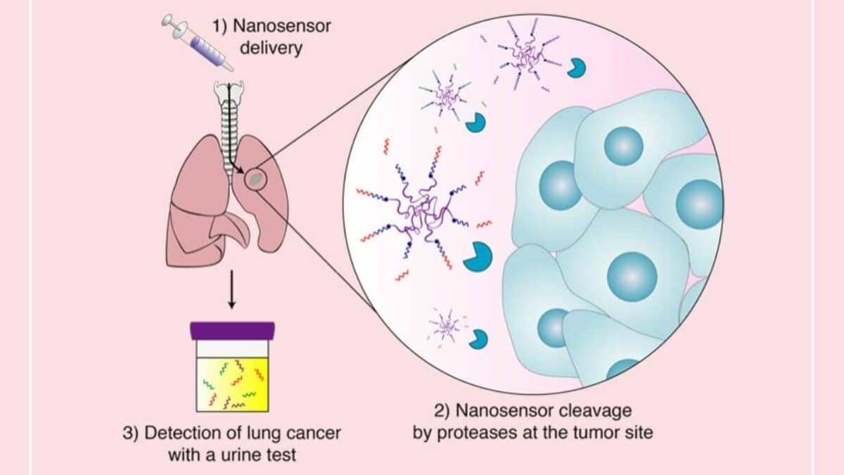 Een revolutie in de detectie van longkanker: de opkomst van urinetests en nanosensoren