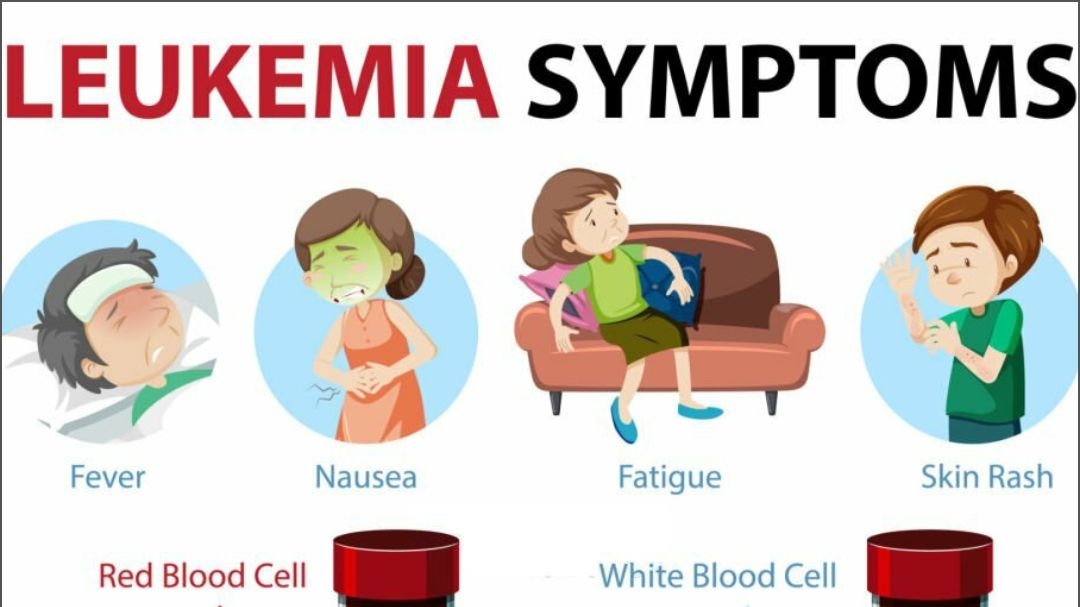 Understanding Childhood Leukemia: Symptoms, Diagnosis, and Treatment
