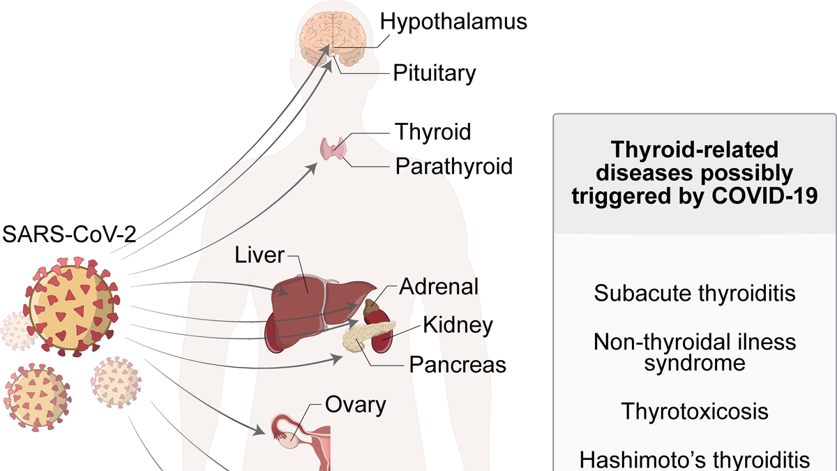 Unraveling the Connection Between COVID-19 and Thyroid Illnesses: An In-depth Analysis