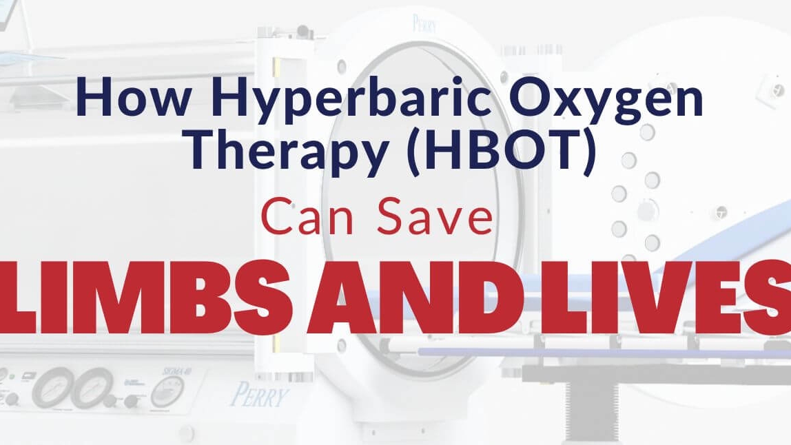 Exploring Hyperbaric Oxygen Therapy: A Potential Game-Changer for Post-Covid Treatment