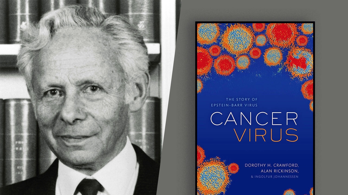 Remembering Michael Anthony Epstein: The Pathologist Behind the Discovery of Epstein-Barr Virus